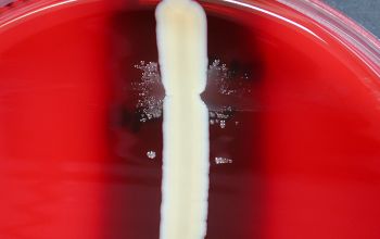 Abiotrophia defectiva Blood Agar 24h culture incubated with CO2