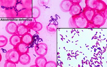 Abiotrophia defectiva Gram stain