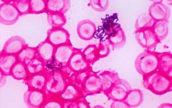 Abiotrophia defectiva Gram stain