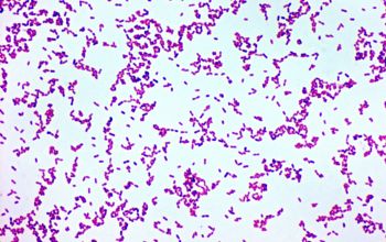 Abiotrophia defectiva Gram stain