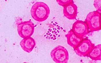 Acinetobacter baumannii Gram stain