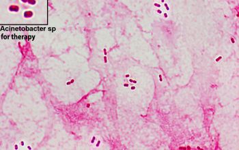 Acinetobacter baumannii Gram stain