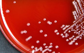 Actinobacillus ureae Blood Agar 24h culture incubated with CO2