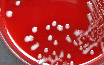 Actinobacillus ureae Blood Agar 48h culture incubated with CO2