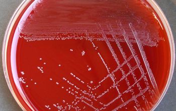 Actinotignum schaalii  / Actinobaculum schaalii Blood Agar 48h culture incubated with CO2