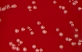 Actinotignum schaalii  / Actinobaculum schaalii Blood Agar 48h culture incubated with CO2