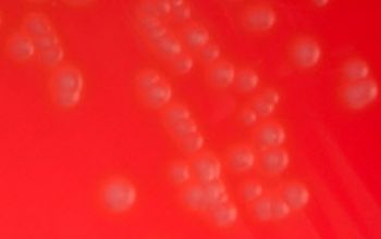 Actinotignum schaalii  (Actinobaculum schaalii)  culture incubated with CO2