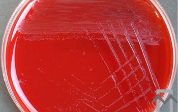 Actinotignum schaalii  (Actinobaculum schaalii) Blood Agar 24h culture incubated with CO2