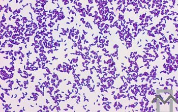 Actinotignum schaalii  (Actinobaculum schaalii) Gram stain