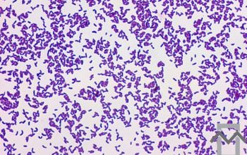 Actinotignum schaalii  / Actinobaculum schaalii Gram stain