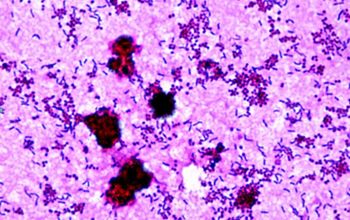 Actinotignum schaalii  (Actinobaculum schaalii) Gram stain
