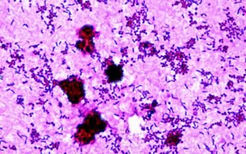 Actinotignum schaalii  / Actinobaculum schaalii Gram stain