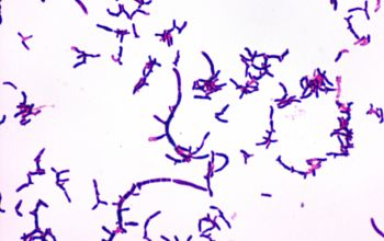 Actinomyces graevenitzii Gram stain