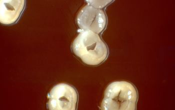 Actinomyces graevenitzii  culture incubated with CO2