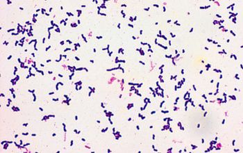 Actinomyces graevenitzii Gram stain