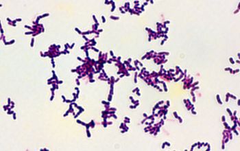 Actinomyces graevenitzii Gram stain