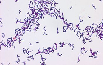 Actinomyces israelii Gram stain