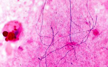 Actinomyces israelii Gram stain