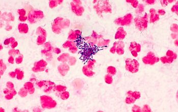 Actinomyces israelii Gram stain