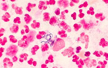 Actinomyces israelii Gram stain