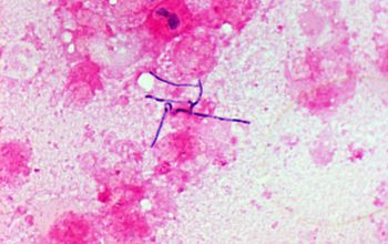 Actinomyces israelii Gram stain