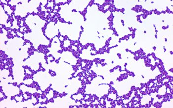 Actinomyces neuii  (Winkia neuii) Gram stain