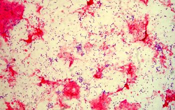 Schaalia odontolytica  (Actinomyces odontolyticus) Gram stain