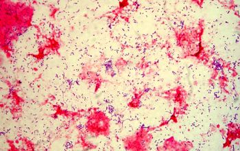 Schaalia odontolytica / Actinomyces odontolyticus Gram stain