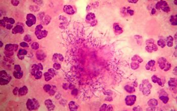 Schaalia odontolytica  (Actinomyces odontolyticus) Gram stain