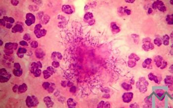 Actinomyces odontolyticus (Schaalia odontolytica) Gram stain