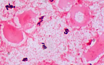 Schaalia odontolytica / Actinomyces odontolyticus Gram stain