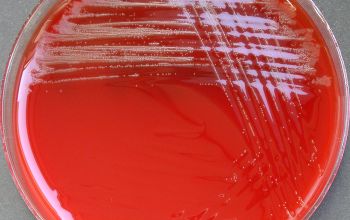 Actinomyces odontolyticus / Schaalia odontolytica Blood Agar 24h culture incubated with CO2