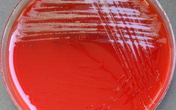 Schaalia odontolytica  (Actinomyces odontolyticus) Blood Agar 24h culture incubated with CO2