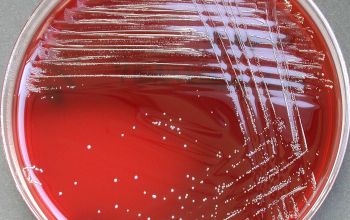 Schaalia odontolytica  (Actinomyces odontolyticus) Blood Agar 48h culture incubated with CO2