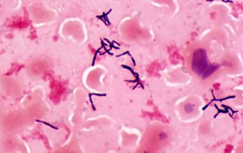 Actinomyces  oris Gram stain