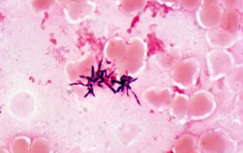 Actinomyces  oris Gram stain