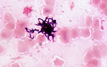 Actinomyces  oris Gram stain