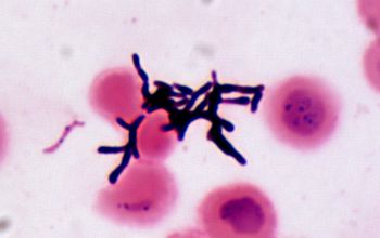 Actinomyces  oris Gram stain