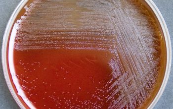 Schaalia turicensis  (Actinomyces turicensis) Blood Agar 48h culture incubated with CO2