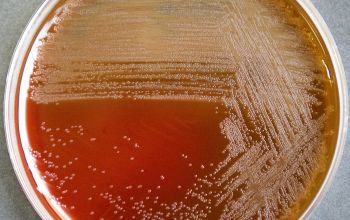 Schaalia turicensis  (Actinomyces turicensis) Blood Agar 24h culture incubated with CO2