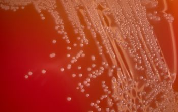 Schaalia turicensis  (Actinomyces turicensis) Blood Agar 24h culture incubated with CO2