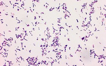 Schaalia turicensis  (Actinomyces turicensis) Gram stain