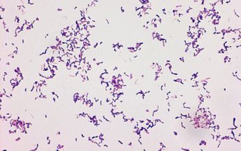 Schaalia turicensis  (Actinomyces turicensis) Gram stain
