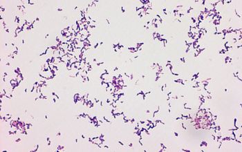 Actinomyces turicensis / Schaalia turicensis Gram stain