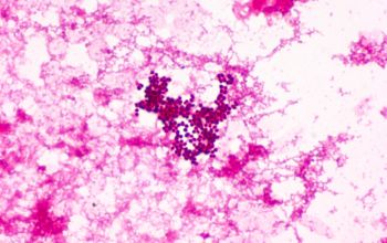 Aerococcus urinae Gram stain