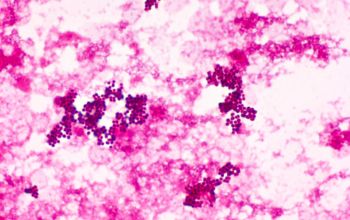 Aerococcus urinae Gram stain