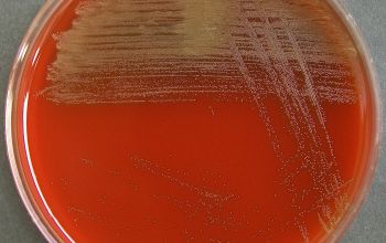 Aerococcus urinae Blood Agar 24h culture incubated with CO2