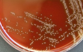 Aerococcus urinae Blood Agar 48h culture incubated with CO2