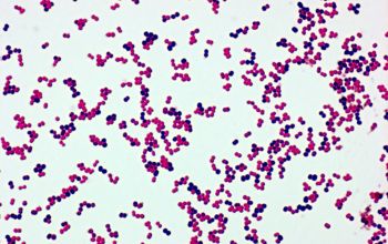 Aerococcus urinae Gram stain