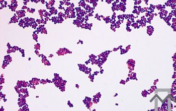 Aerococcus viridans Gram stain